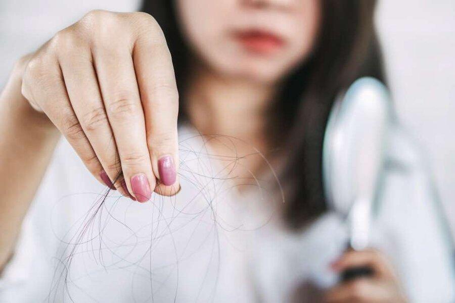 آیا کرونا می تواند باعث ریزش مو شود؟ آیا کرونا می تواند باعث ریزش مو گردد؟